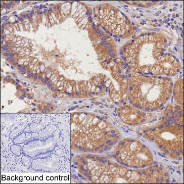 STX17 Antibody in Immunohistochemistry (Paraffin) (IHC (P))
