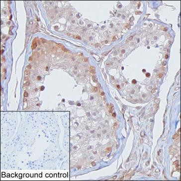 TSNAX Antibody in Immunohistochemistry (Paraffin) (IHC (P))
