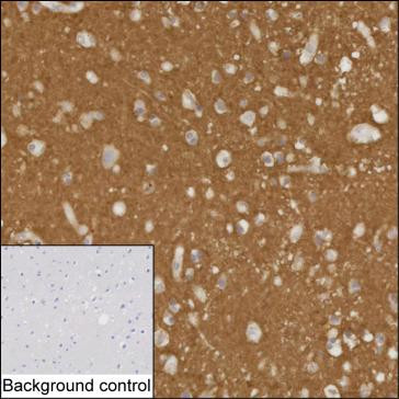 BASP1 Antibody in Immunohistochemistry (Paraffin) (IHC (P))