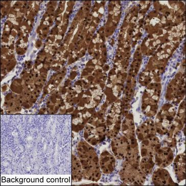 Annexin A10 Antibody in Immunohistochemistry (Paraffin) (IHC (P))
