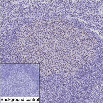 TOP1 Antibody in Immunohistochemistry (Paraffin) (IHC (P))