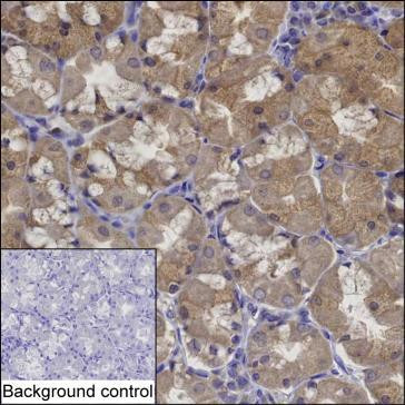 Layilin Antibody in Immunohistochemistry (Paraffin) (IHC (P))