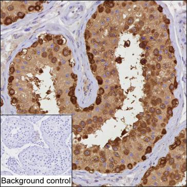 STIP1 Antibody in Immunohistochemistry (Paraffin) (IHC (P))