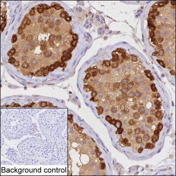 STIP1 Antibody in Immunohistochemistry (Paraffin) (IHC (P))