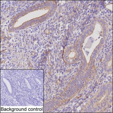 ENAH Antibody in Immunohistochemistry (Paraffin) (IHC (P))