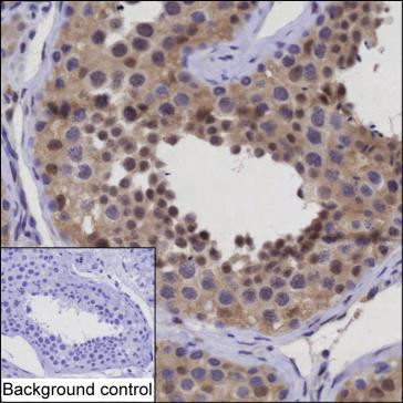 ICAD Antibody in Immunohistochemistry (Paraffin) (IHC (P))