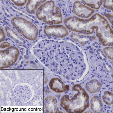 NDUFAF1 Antibody in Immunohistochemistry (Paraffin) (IHC (P))