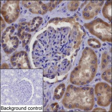 NDUFAF1 Antibody in Immunohistochemistry (Paraffin) (IHC (P))