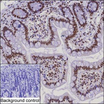 SSB Antibody in Immunohistochemistry (Paraffin) (IHC (P))