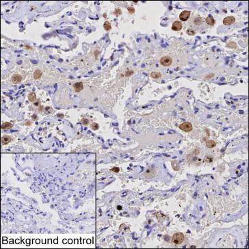 CAPG Antibody in Immunohistochemistry (Paraffin) (IHC (P))