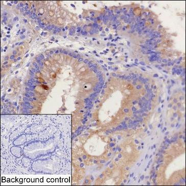 STX17 Antibody in Immunohistochemistry (Paraffin) (IHC (P))