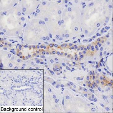 HIP1 Antibody in Immunohistochemistry (Paraffin) (IHC (P))