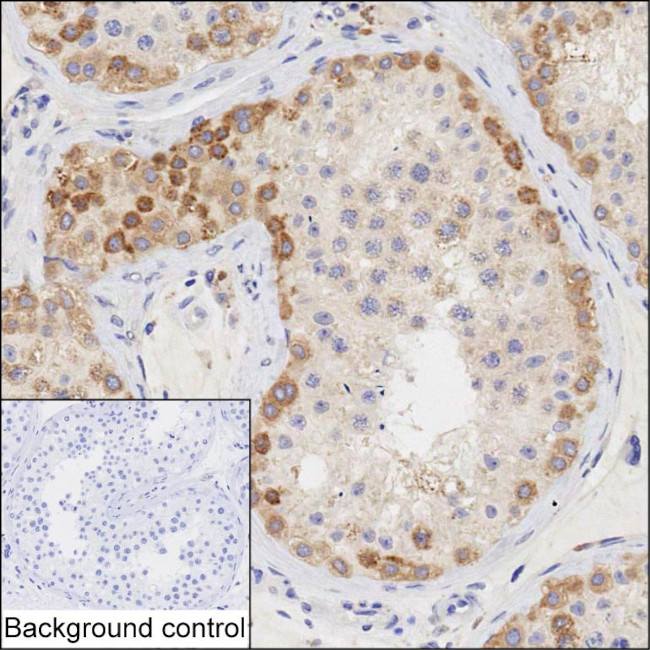 HERC5 Antibody in Immunohistochemistry (Paraffin) (IHC (P))