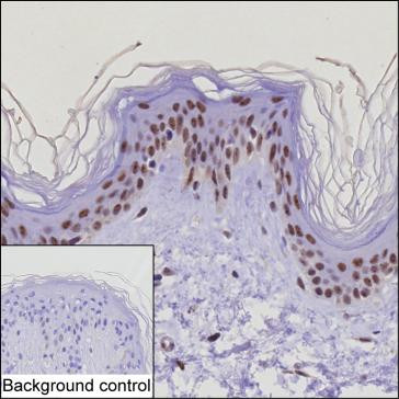 EXOSC10 Antibody in Immunohistochemistry (Paraffin) (IHC (P))