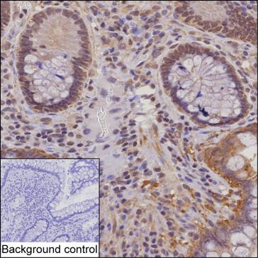 NYREN18 Antibody in Immunohistochemistry (Paraffin) (IHC (P))