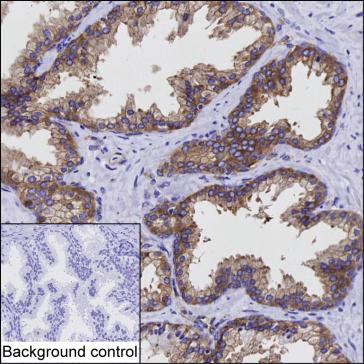 PAK4 Antibody in Immunohistochemistry (Paraffin) (IHC (P))
