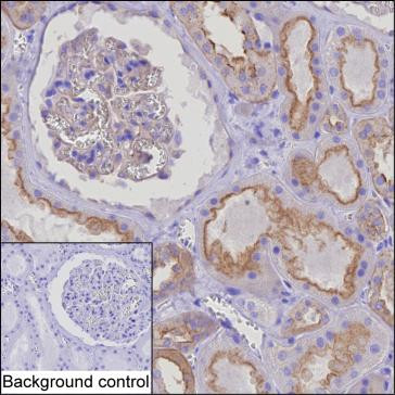 HIP1R Antibody in Immunohistochemistry (Paraffin) (IHC (P))
