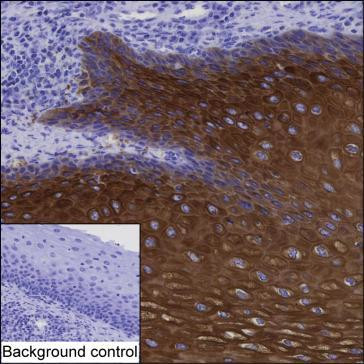 Cytokeratin 6A Antibody in Immunohistochemistry (Paraffin) (IHC (P))