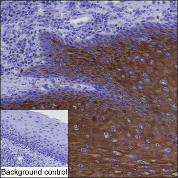 Cytokeratin 6A Antibody in Immunohistochemistry (Paraffin) (IHC (P))