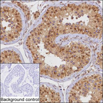 RANGAP1 Antibody in Immunohistochemistry (Paraffin) (IHC (P))