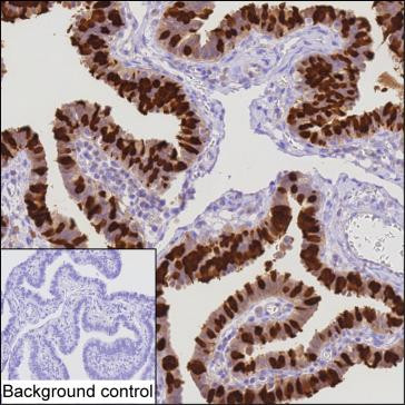 CAPS Antibody in Immunohistochemistry (Paraffin) (IHC (P))