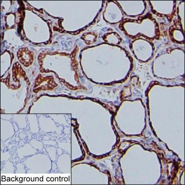 MDA5 Antibody in Immunohistochemistry (Paraffin) (IHC (P))