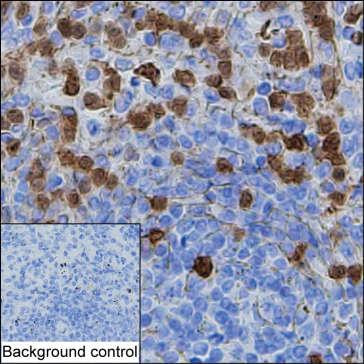 CDA Antibody in Immunohistochemistry (Paraffin) (IHC (P))