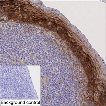 FGFBP1 Antibody in Immunohistochemistry (Paraffin) (IHC (P))