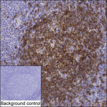 NTAL Antibody in Immunohistochemistry (Paraffin) (IHC (P))
