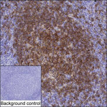 NTAL Antibody in Immunohistochemistry (Paraffin) (IHC (P))