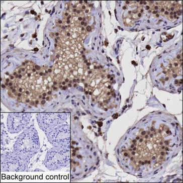 RCOR1 Antibody in Immunohistochemistry (Paraffin) (IHC (P))