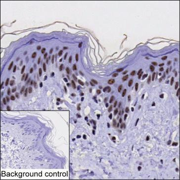 EXOSC10 Antibody in Immunohistochemistry (Paraffin) (IHC (P))