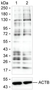 Lactyl Lysine Antibody in Western Blot (WB)