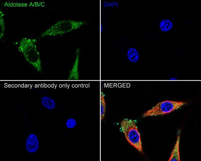 Aldolase A/B/C Antibody in Immunocytochemistry (ICC/IF)
