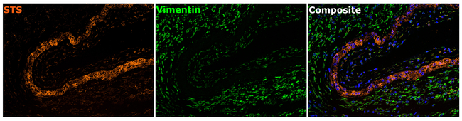 STS Antibody in Immunohistochemistry (Paraffin) (IHC (P))