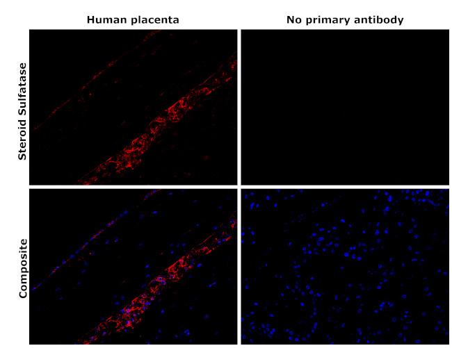 STS Antibody in Immunohistochemistry (Paraffin) (IHC (P))