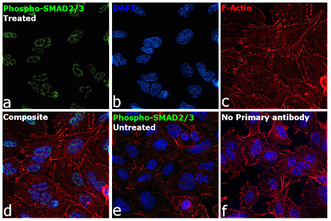 Phospho-SMAD2/SMAD3 (Ser465, Ser467, Ser423, Ser425) Antibody in Immunocytochemistry (ICC/IF)