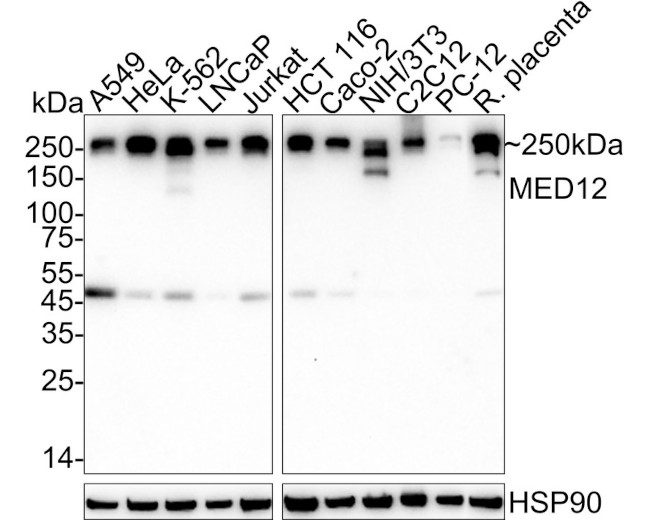 MED12 Antibody in Western Blot (WB)