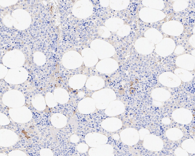 CD42b Antibody in Immunohistochemistry (Paraffin) (IHC (P))