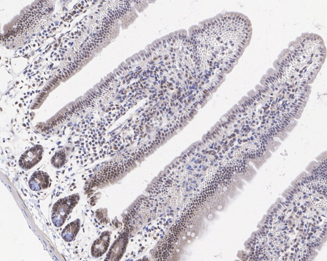 PRMT4 Antibody in Immunohistochemistry (Paraffin) (IHC (P))