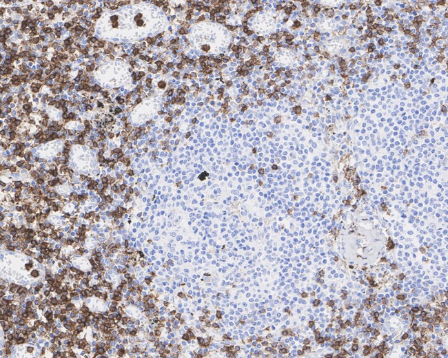Annexin A1 Antibody in Immunohistochemistry (Paraffin) (IHC (P))