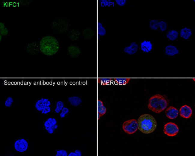 KIFC1 Antibody in Immunocytochemistry (ICC/IF)