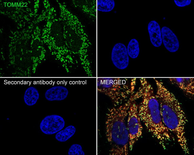 TOMM22 Antibody in Immunocytochemistry (ICC/IF)