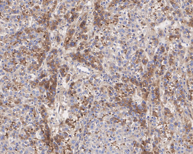 C1S Antibody in Immunohistochemistry (Paraffin) (IHC (P))