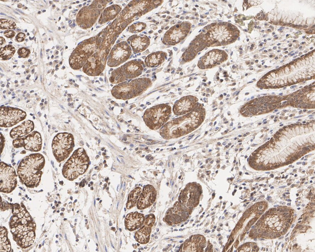 Acid Phosphatase 1 Antibody in Immunohistochemistry (Paraffin) (IHC (P))