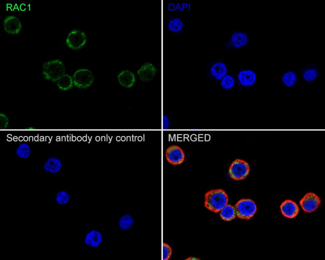 RAC1 Antibody in Immunocytochemistry (ICC/IF)