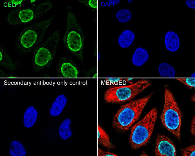 CUGBP1 Antibody in Immunocytochemistry (ICC/IF)