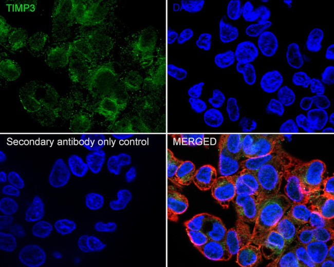 TIMP3 Antibody in Immunocytochemistry (ICC/IF)