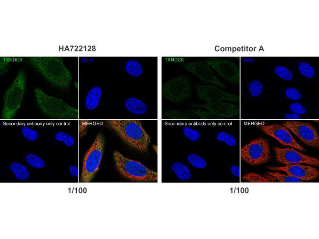 TXNDC9 Antibody in Immunocytochemistry (ICC/IF)