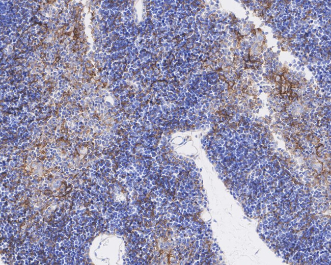 PD-L1 Antibody in Immunohistochemistry (Paraffin) (IHC (P))